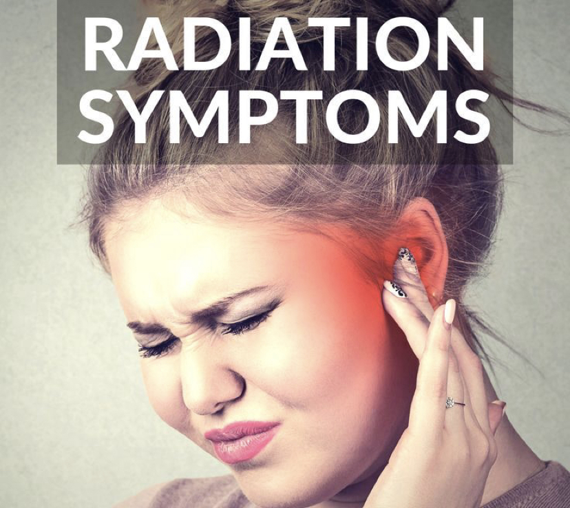 Lady under stress from Radiation Symptoms